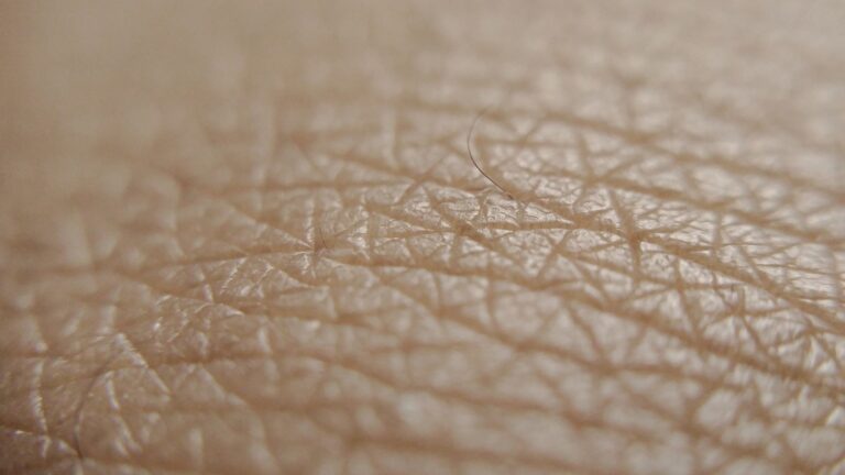 Skóra sucha czy odwodniona? Jak rozpoznać różnicę